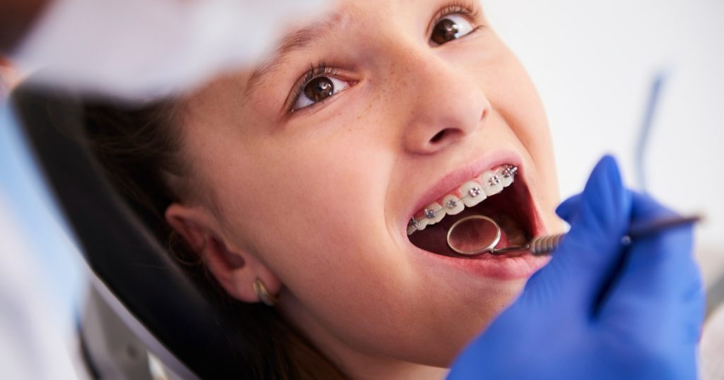 How to Choose the Best Braces for Kids