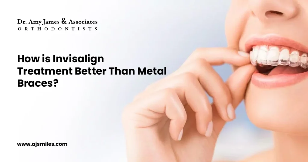 Invisalign Treatment Better Than Metal Braces