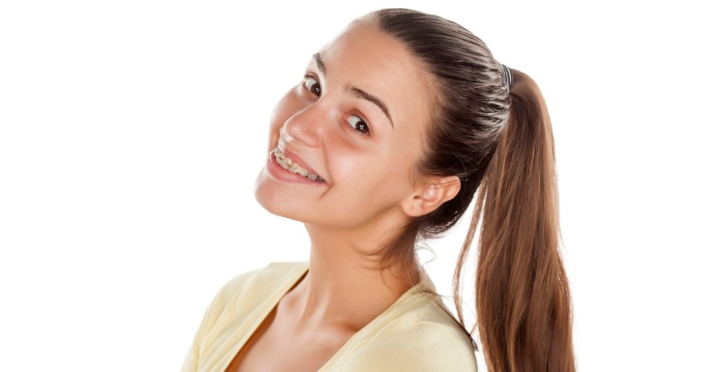 Dental Braces for Adults