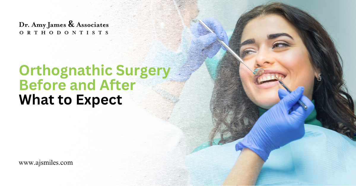 Read more about the article Orthognathic Surgery Before and After: What to Expect