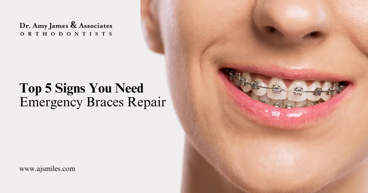 Read more about the article Top 5 Signs You Need Emergency Braces Repair