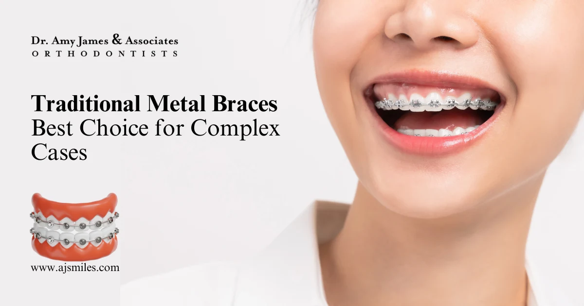 Read more about the article Traditional Metal Braces – Best Choice for Complex Cases