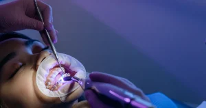 Consider Orthodontic Treatment for Adults