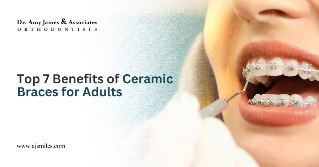 Top 7 Benefits of Ceramic Braces for Adults