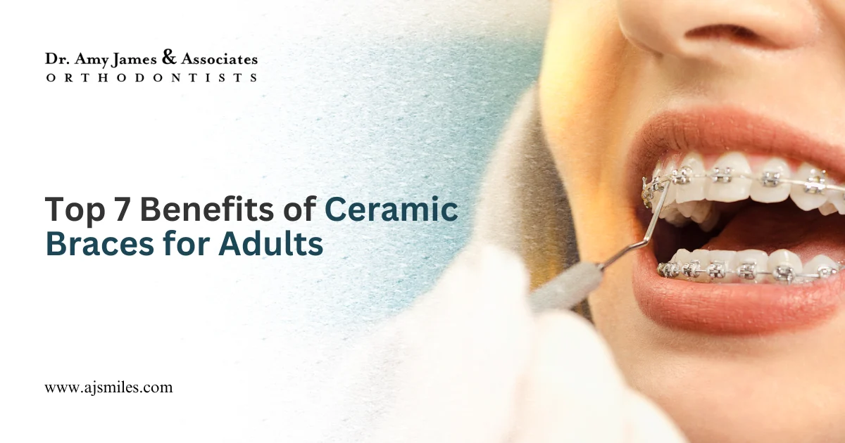 Read more about the article Top 7 Benefits of Ceramic Braces for Adults
