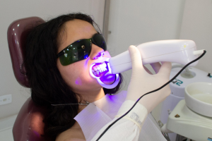 Affordable Teeth Whitening